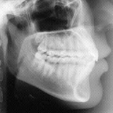 Radiologia Odontológica em Rio Verde